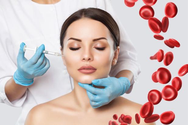 PRP (Platelet Rich Plasma) TEDAVİSİ NEDİR ?